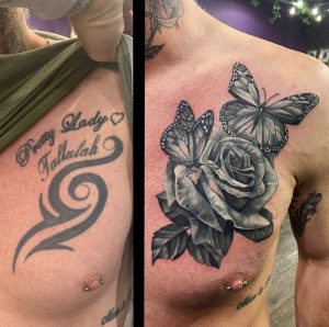 laser tattoo removal and cover up 